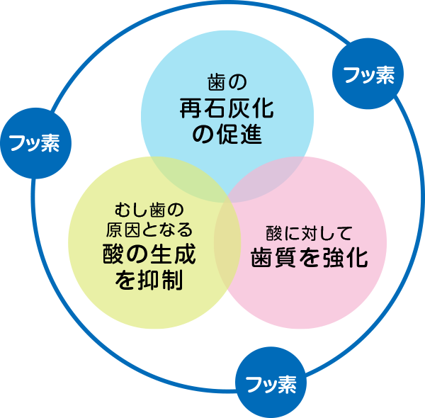 フッ化物塗布がむし歯を予防する