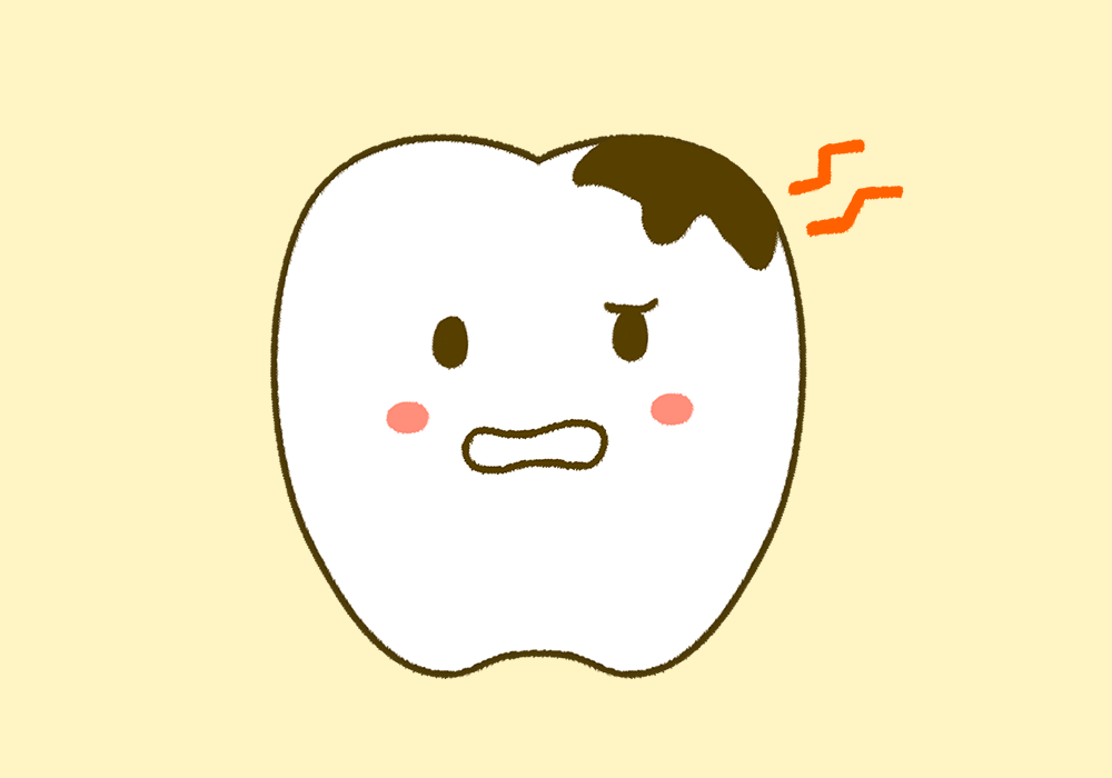 むし歯